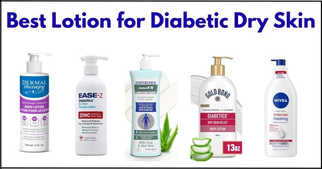 Best Lotion for Diabetic Dry Skin