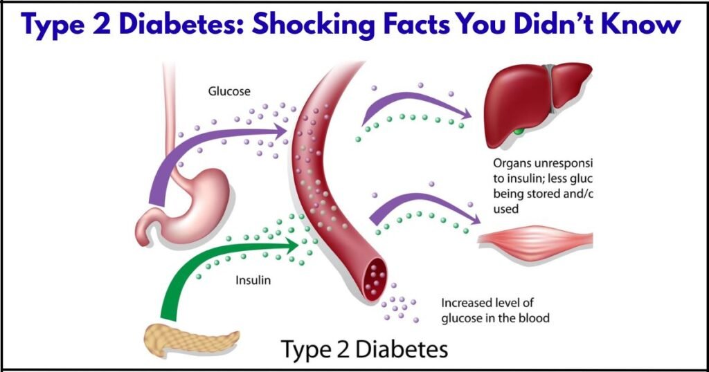 Type 2 Diabetes